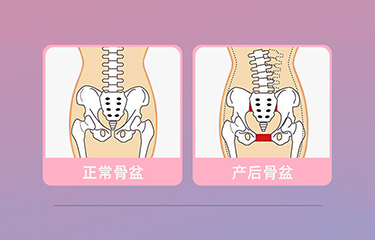 盆底肌修複儀器怎麽樣？哪些人可以使用它呢